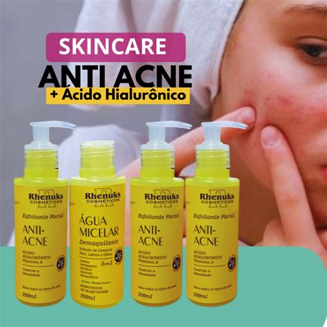 Kit Skincare Anti Acne Completo Vitamina A Hialur Nico Tratamento