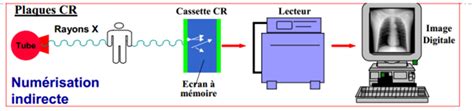 Radiographie Num Rique Les Principes D Imagerie M Dicale Par La