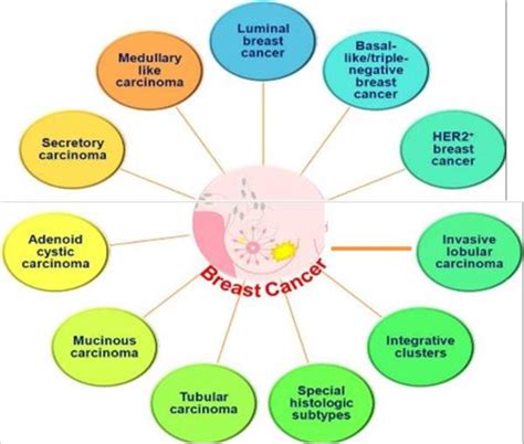 Molecular Classification Of Breast Cancer Download Scientific Diagram