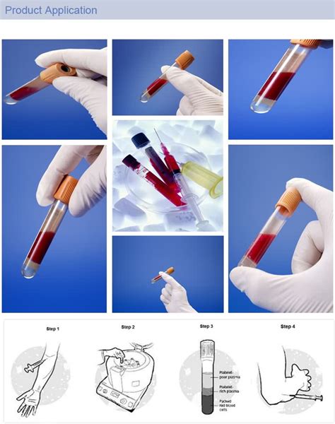 China Low Price Medical Consumables Bd Vacutainer Blood Collection