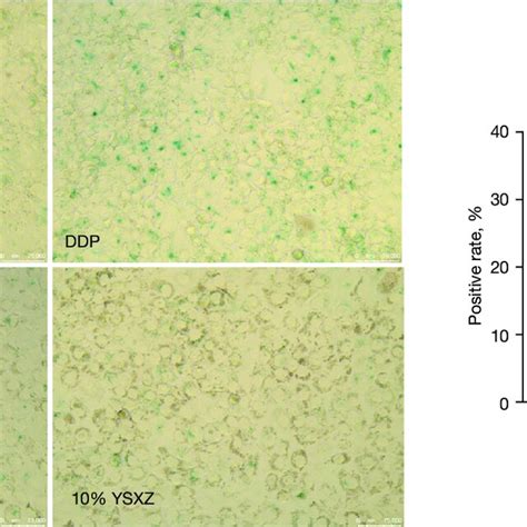 The Effect Of Ysxz On The Sa Gal Activity Of Hkc Treated With Ddp