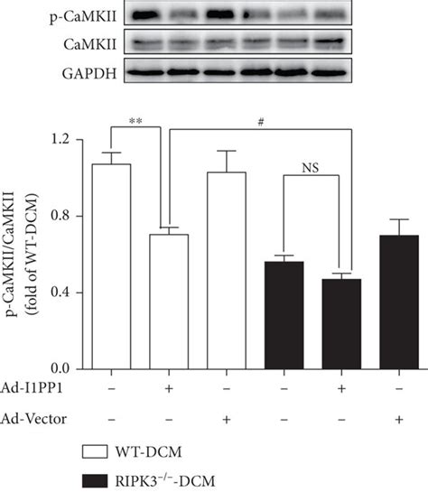 I1pp1 Overexpression Inhibits Oxidation And Phosphorylation Of Camkii