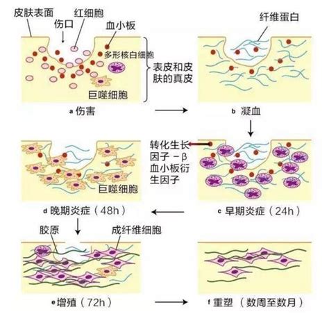 创面愈合分期的四个阶段，重组Ⅲ型人源化胶原蛋白连接因创伤造成的胶创面瘢痕细胞新浪新闻