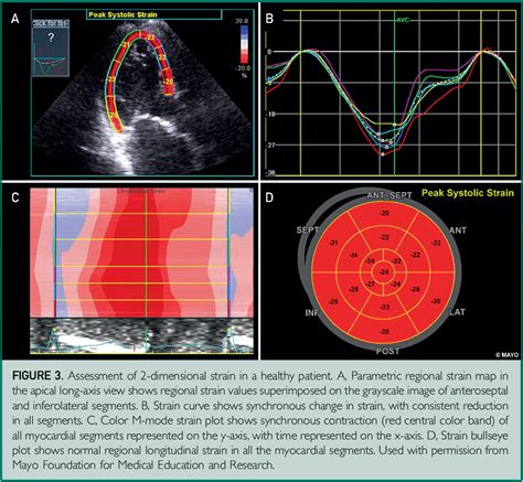 Echocardiographic Assessment Of Left Ventricular Systolic Function An