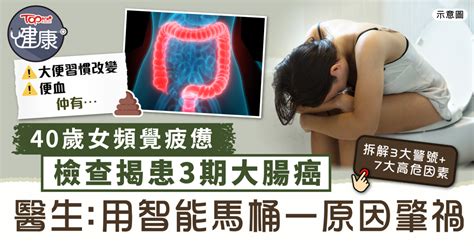 癌症殺手｜40歲女頻覺疲憊 檢查揭患3期大腸癌 醫生：用智能馬桶一原因肇禍