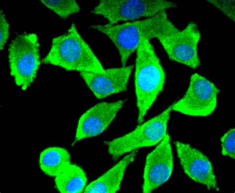 Tau Rabbit Mab Sab Signalway Antibody