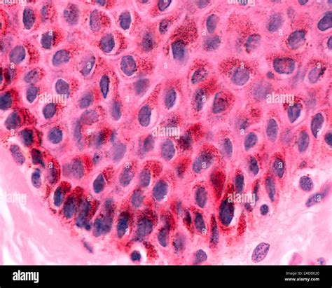 Light micrograph of a section through the epidermis of the skin stained with haematoxylin and ...