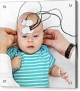 Baby Hearing Test Photograph By Peakstock Science Photo Library