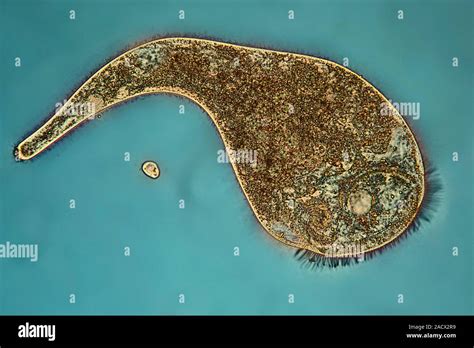 Interphase Contrast Light Micrograph Of A Stentor Sp Freshwater