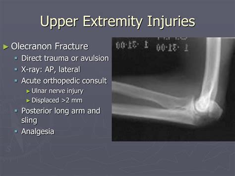 Ppt Orthopedic Trauma Powerpoint Presentation Free Download Id4595663