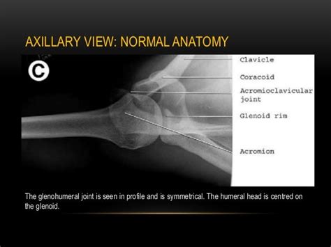 Radiographic Evaluation Of Shoulder