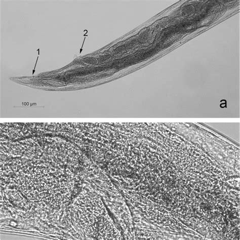 Anterior End Of P Cuniculorum From A Brown Hare From Bulgaria