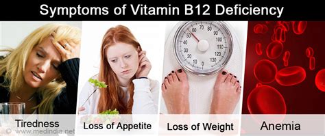 How Long To Recover From Vitamin B Deficiency Public Health