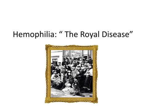 Ppt Hemophilia The Royal Disease” Powerpoint Presentation Free