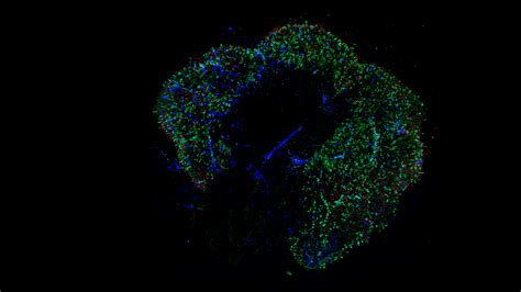 Scientists Grow Human Retinas And Discover How People See Color