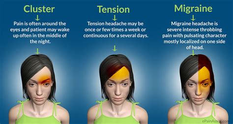 What S The Difference Between Headaches And Migraines Here S How To