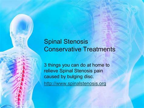 Spinal Stenosis Conservative Treatments Ppt