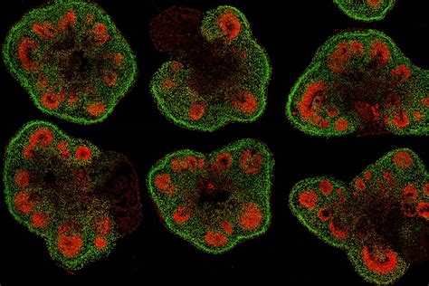 Making lab-grown brain organoids ‘brainier’ | UCLA