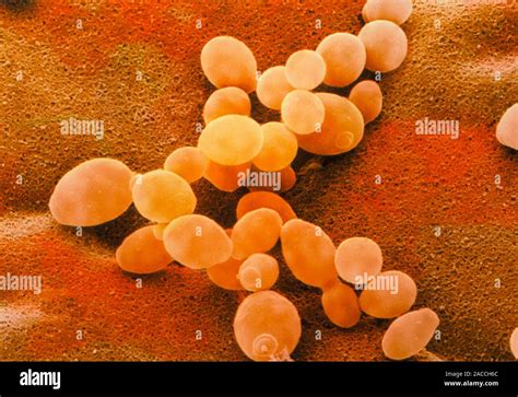 Yeast Cells Coloured Scanning Electron Micro Graph SEM Of Budding