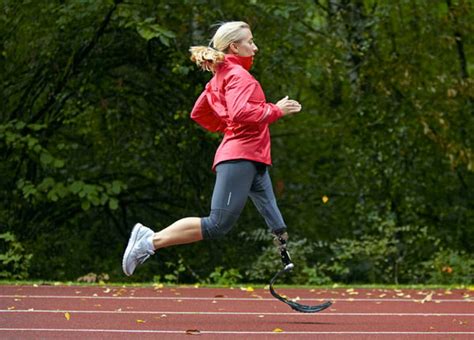 Running With a Prosthetic Leg