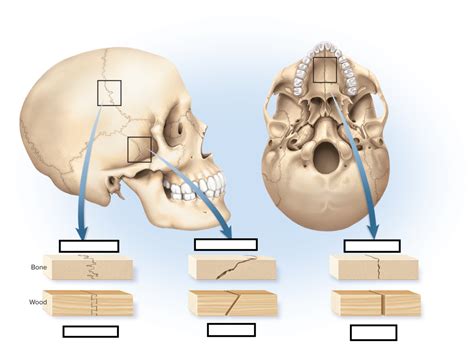 Chapter 9 Sutures Diagram Quizlet