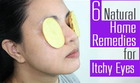 6 Natural Home Remedies for Itchy Eyes - The Wellness Corner