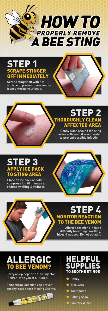 Ultimate Protection From Bees And Wasps Infographic Bee Sting