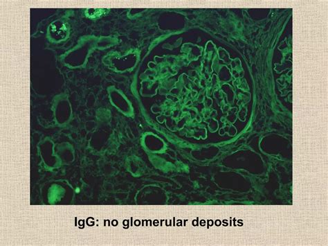 Pediatric fibromuscular dysplasia of renal arteries | PPT