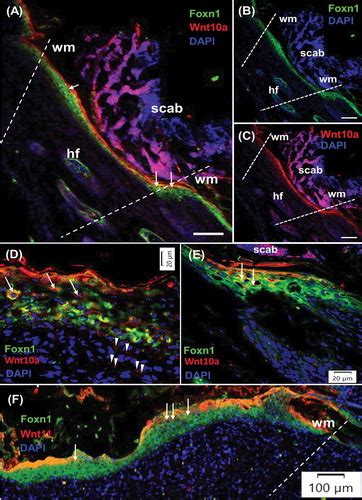 Full Article Wnt Signaling And The Transcription Factor Foxn1