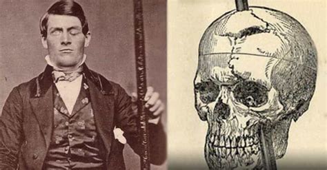 Horrifying Facts About Phineas Gage The Man Who Impaled His Brain