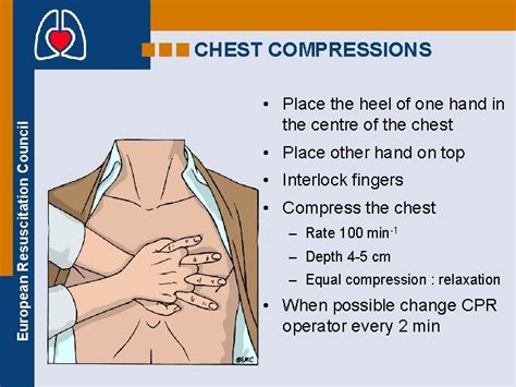 European Resuscitation Council ADULT BASIC LIFE SUPPORT BLS