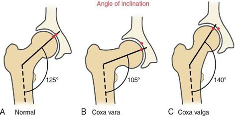 So...Why Tall Kneeling? | Functional Movement Systems