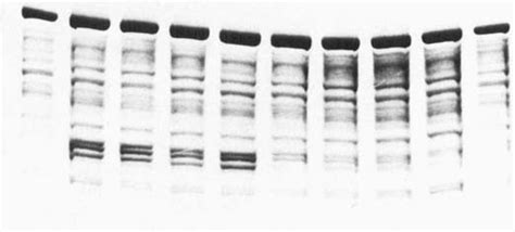 Western Blot Of Kainic Acid Induced Spectrin Proteolysis Following