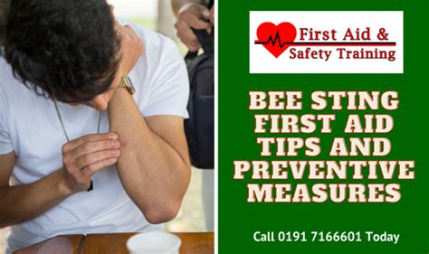 Bee Sting First Aid Tips And Preventive Measures