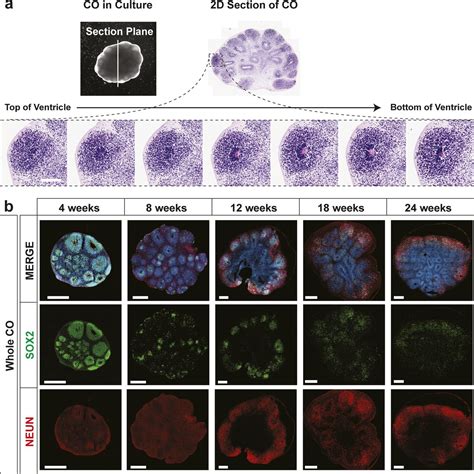 Robust Production Of Uniform Human Cerebral Organoids From Pluripotent