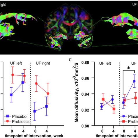 Uncinate Fasciculus Uf Tract Dti Tractography A Virtual Dissection