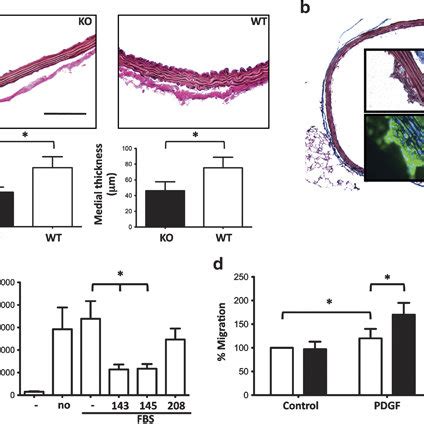 Morphological Changes In The Vasculature Of MiR 143 145 KO Mice A