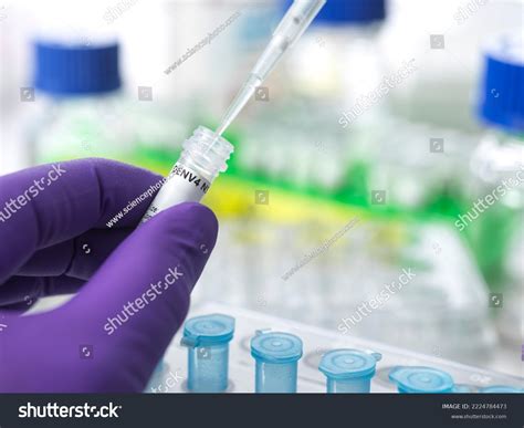 Scientist Pipetting Vial Containing Antigen Dengue Stock Photo