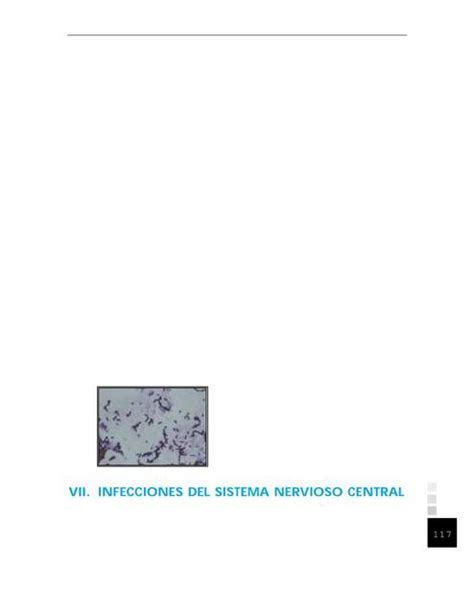 Infecciones Del Sistema Nervioso Central Mr Buiton Udocz