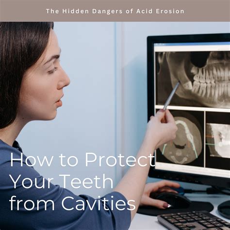 North - Did you know that acid erosion can lead to dental cavities