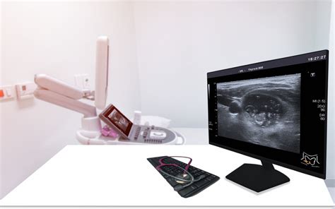 Private Thyroid Gland Ultrasound Scan in London