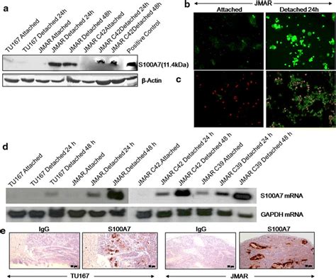 Up Regulation Of S A Protein And Mrna During Detachment Of Anoikis