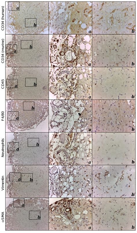 Immunohistochemical Characterization Of Explanted Human Vascularized