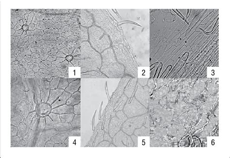 Microdiagnostic features of rachis Astragalus glycyphyllus L. 1 -cross ...