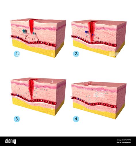 Guarigione Della Ferita Disegno Foto Stock Alamy