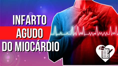 Infarto Agudo Do Mioc Rdio Causas Sintomas E Tratamento Youtube