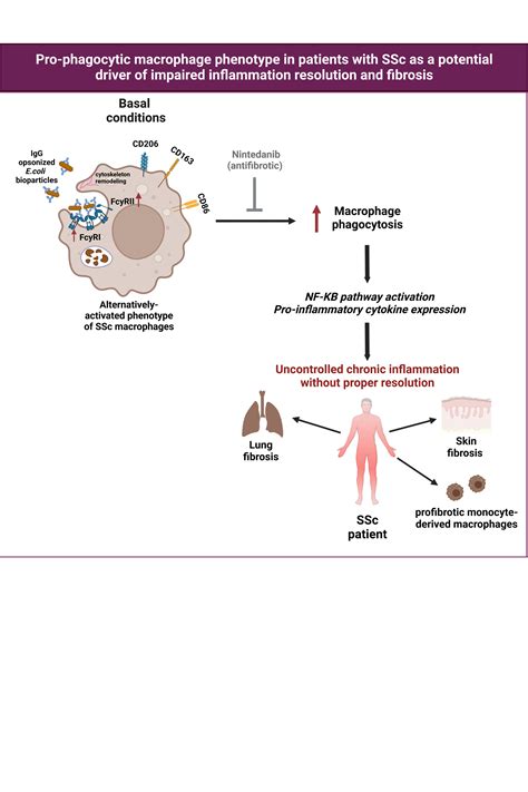 Fcγ Receptors Define Pro Phagocytic Macrophages And Trigger Pro Inflammatory Responses In