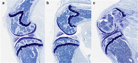 Knee Immobilization Reproduces Key Arthrofibrotic Phenotypes In Mice