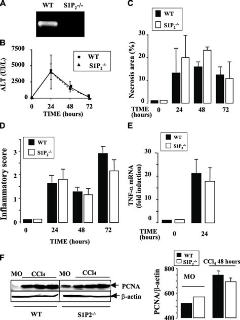 Genetic Inactivation Of S P Does Not Affect Liver Injury And