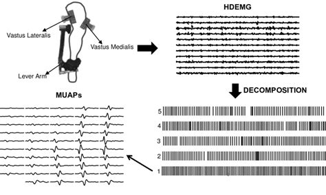 Schematic Summarizing High Density Surface Emg Hdemg Recordings And